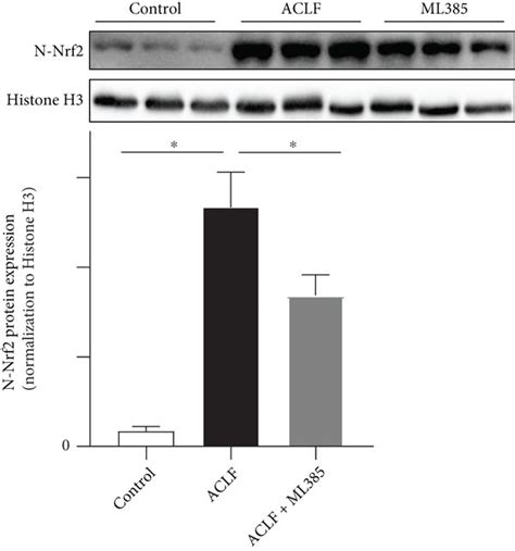 Nrf2 inhibition promoted the onset of lipid peroxidation and aggravated ...