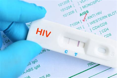 HIV Testing Singapore | Discreet | 2022 Process