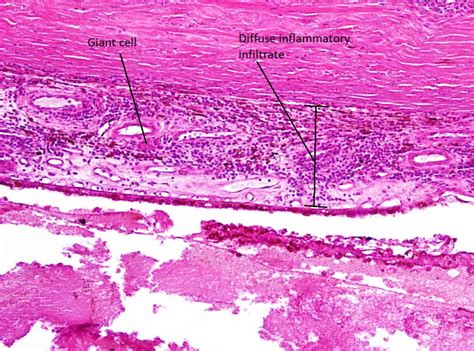 Moran Core Cellular Histopathology