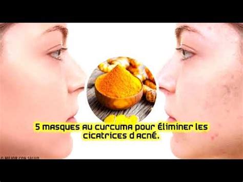 5 masques au curcuma pour éliminer les cicatrices dacné YouTube