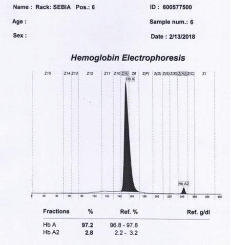 Laboratory Diagnosis Of β Thalassemia And Hbe Intechopen