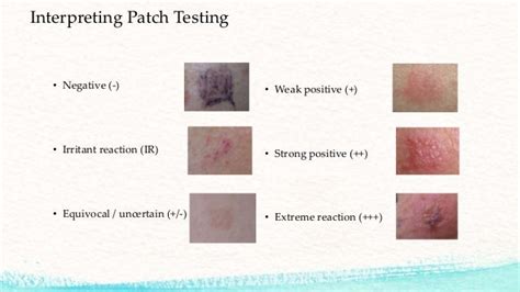 Patch Testing A To Z