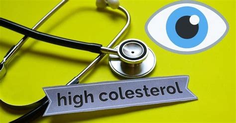 Warning Signals Of High Cholesterol Symptoms In Eyes By Samirpandey