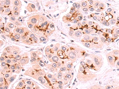 Abcb Anti Abcb Rabbit Polyclonal Antibody