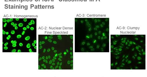 معلومات عن تحليل Anti Nuclear Antibodies تحاليل طبية Lab For Arab