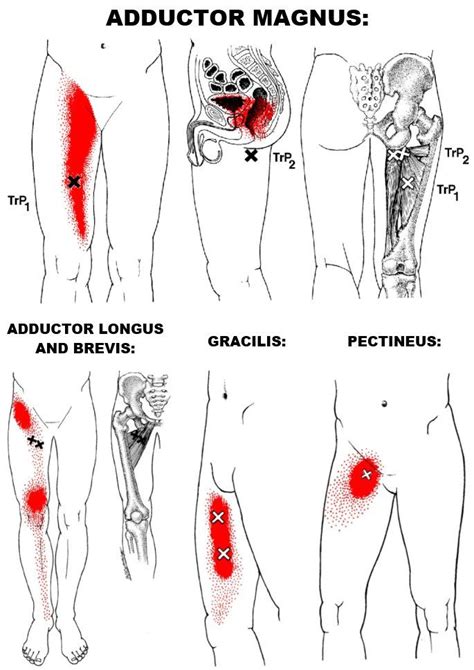 adductor anatomy - Google Search | Pain relief massage, Pelvic pain, Inner thigh muscle