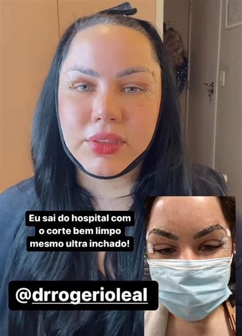 Blogueira de beleza mostra antes e depois de cirurgia nas pálpebras