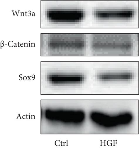 Wnt Signaling Pathway Was Involved During Hepatic Differentiation Of