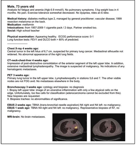 Variation Between Multidisciplinary Tumor Boards In Clinical Staging And Treatment