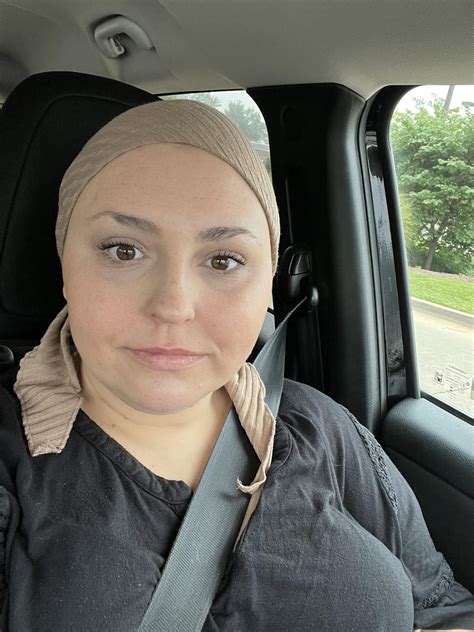 Hair Cover Rtrichotillomania