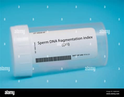 Sperm DNA Fragmentation Index Test Stock Photo Alamy