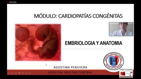 Clase De Embriología Y Anatomía Parte 1 Modulo De Cardiopatías