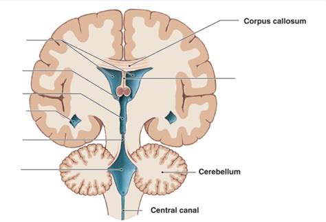 Coronal View of Ventricles Diagram | Quizlet