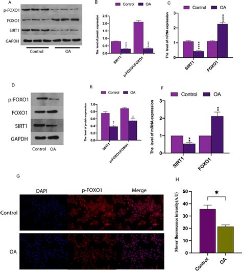 The SIRT1 FOXO1 Pathway Was Downregulated In OA Cartilage Cells From