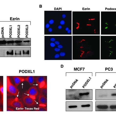 Podocalyxin And Ezrin Coimmunoprecipitate And Colocalize In Mcf Podxl