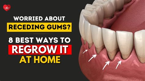 8 Best Ways To GROW BACK Your Receding Gums Naturally AT HOME