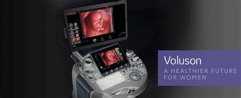 ge voluson   arrived  precious glimpse