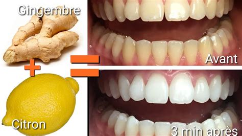 3 ingrédients pour blanchir ses dents en 3 minutes naturellement YouTube