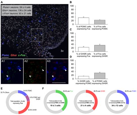 Colocalization Of Mrnas For Fos Protein Ghsr And Pomc In The Arc Of