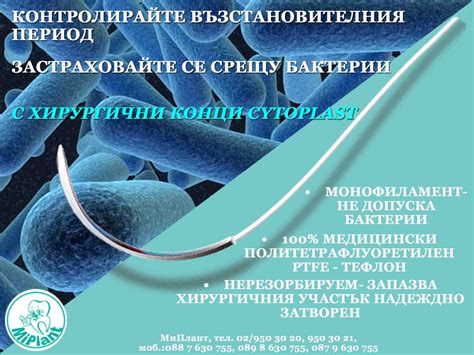 Хирургични конци Citoplast | Dental.bg