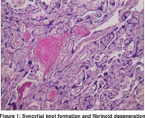 Figure From Comparative Study Of Placental Morphometry And