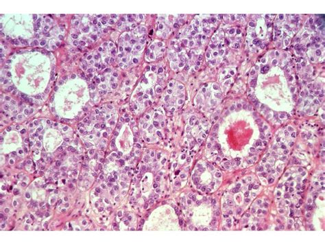 Histopathology Of The Uterine Cervix Digital Atlas