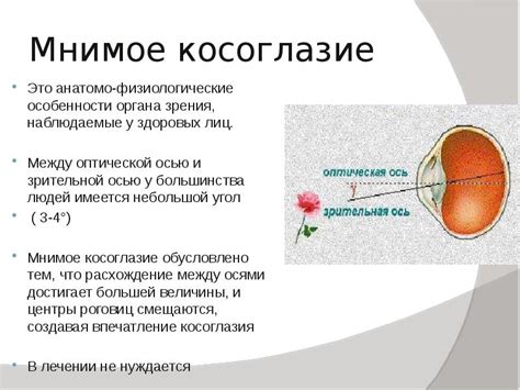 КОСОГЛАЗИЕ Булат Алена Ложечкин александр МЛ 405