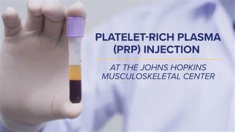 Prp Platelet Rich Plasma Board Certified Md Louisiana