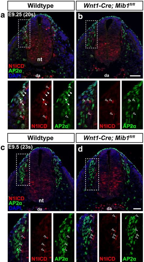 Notch Signalling Is Active In Neural Crest Cells At The Earliest Stages