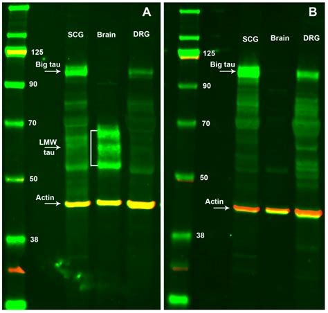 Cells Free Full Text Regulation Of Tau Expression In Superior