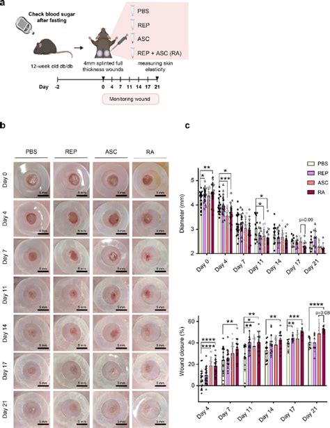 REPs improve the efficiency of adipose-derived stem cell-mediated wound ...