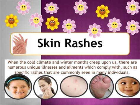 Frequent Winter Rashes and Skin Disorders - Fully grasp Some Typical Rash Troubles