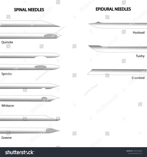 Spinal Needle Images Stock Photos Vectors Shutterstock