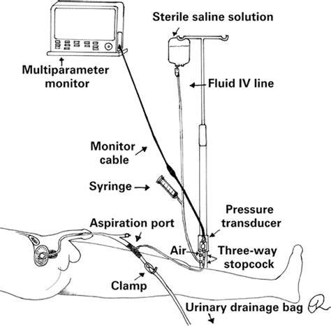 Scielo Brasil Intra Abdominal Pressure An Integrative Review Intra Abdominal Pressure An