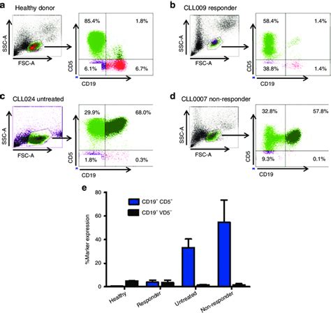 Distribution Of Lymphocyte Subsets In Chronic Lymphocytic Leukemia Download Scientific Diagram