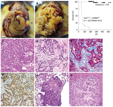 Genetically Engineered Mouse Models For Pancreatic Cancer Advances And Current Limitations