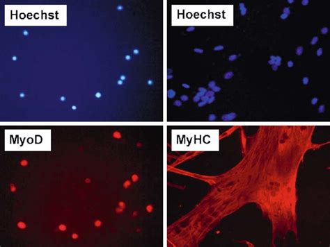 3 Monitoring Myogenic Differentiation By Myod And Myhc Expression