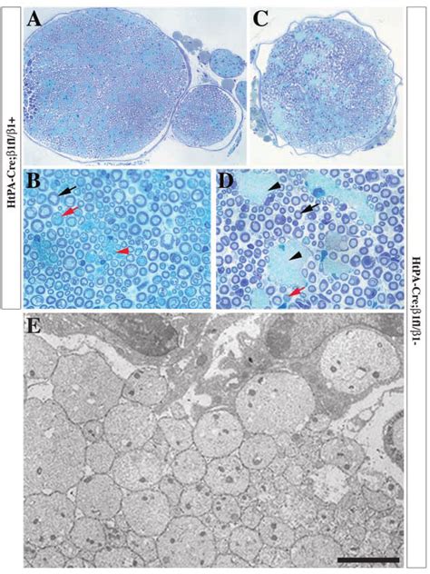 Morphological analysis of sciatic nerves. Semithin sections of sciatic ... 