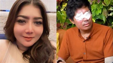 Hotman Paris Sindir Alvin Lim Yang Tangani Kasus Agus Salim Kamu