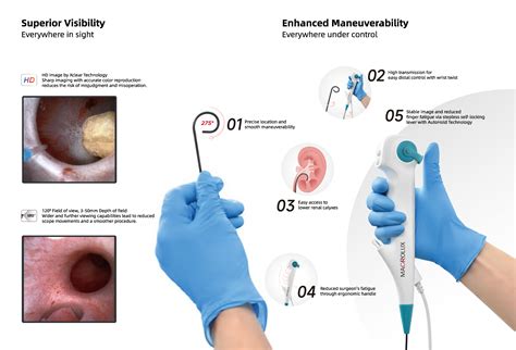 Coralview U Series Single Use Digital Flexible Ureteroscope