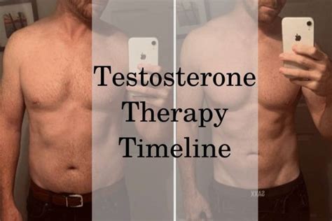 TRT Results of Patients | Timeline of Benefits Month by Month | HFS Clinic