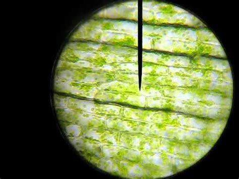 Elodea Under Microscope 400X