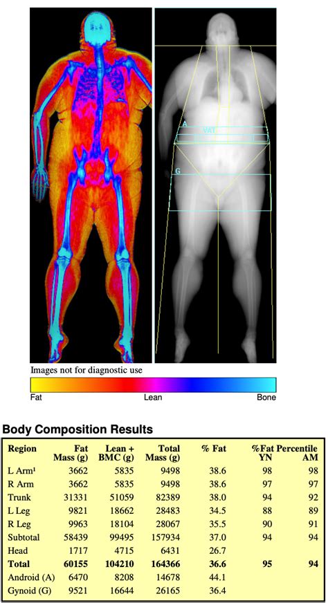 Private Dexa Scan Body Fat Measurement Bodyscan Uk