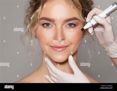 Plastic Surgeon Drawing Contours With Black Pen Around Female Eye