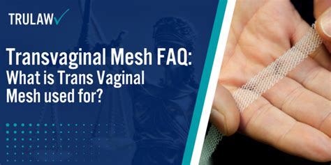 Faq What Is Trans Vaginal Mesh Used For Trulaw