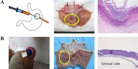 Rat Experimental Model Of Acetic Acid Induced Gastric Ulcer Ulcer Download Scientific Diagram