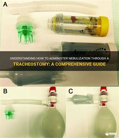 Understanding How To Administer Nebulization Through A Tracheostomy A