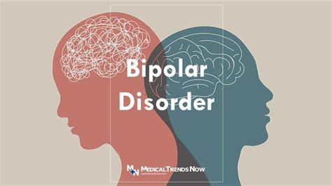 Understanding Bipolar Disorder What You Need To Know Medical Trends Now