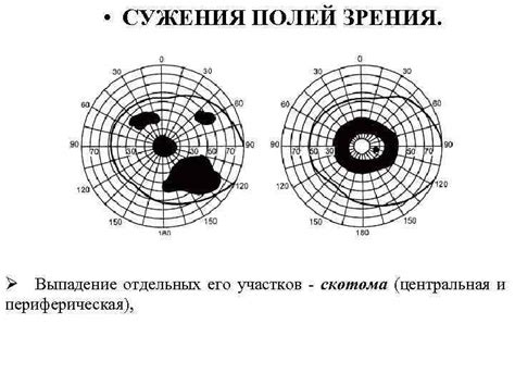 КЛИНИСЕСКАЯ АНАТОМИЯ И СИНДРОМЫ ПОРАЖЕНИЯ ЧЕРЕПНО-МОЗГОВЫХ НЕРВОВ