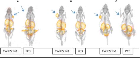 3D MicroPET CT Images At 2 H Postinjection Of Male Nude Mice Bearing